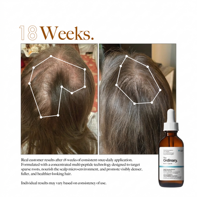 The Ordinary Multi-Peptide Serum for Hair Density – 2 Fl Oz (60ml)