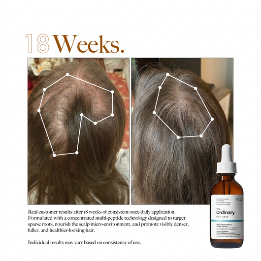 The Ordinary Multi-Peptide Serum for Hair Density – 2 Fl Oz (60ml)